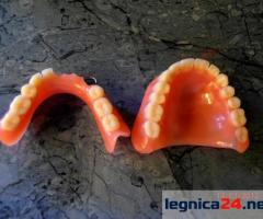 Naprawa protez zębowych – Legnica